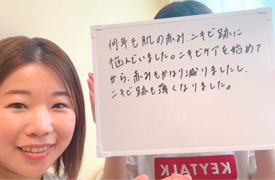 みよし市 20代女性 ニキビケア体験談 5回目で肌の変化を実感
